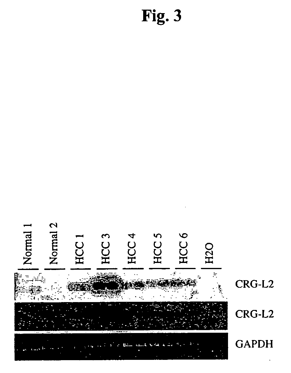 Liver tumor marker sequences