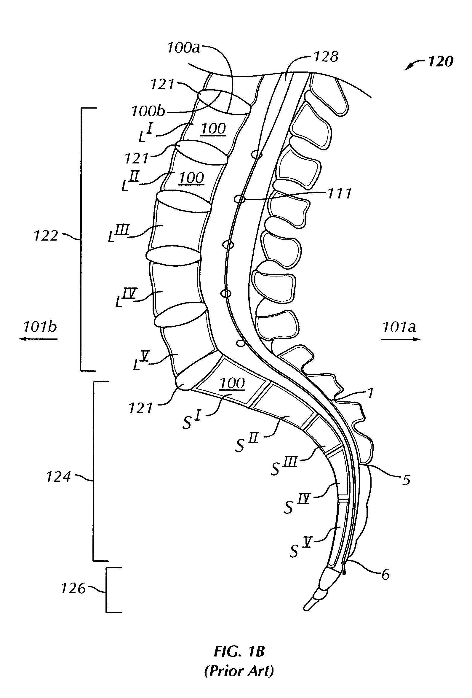 Working channel for minimally invasive spine surgery