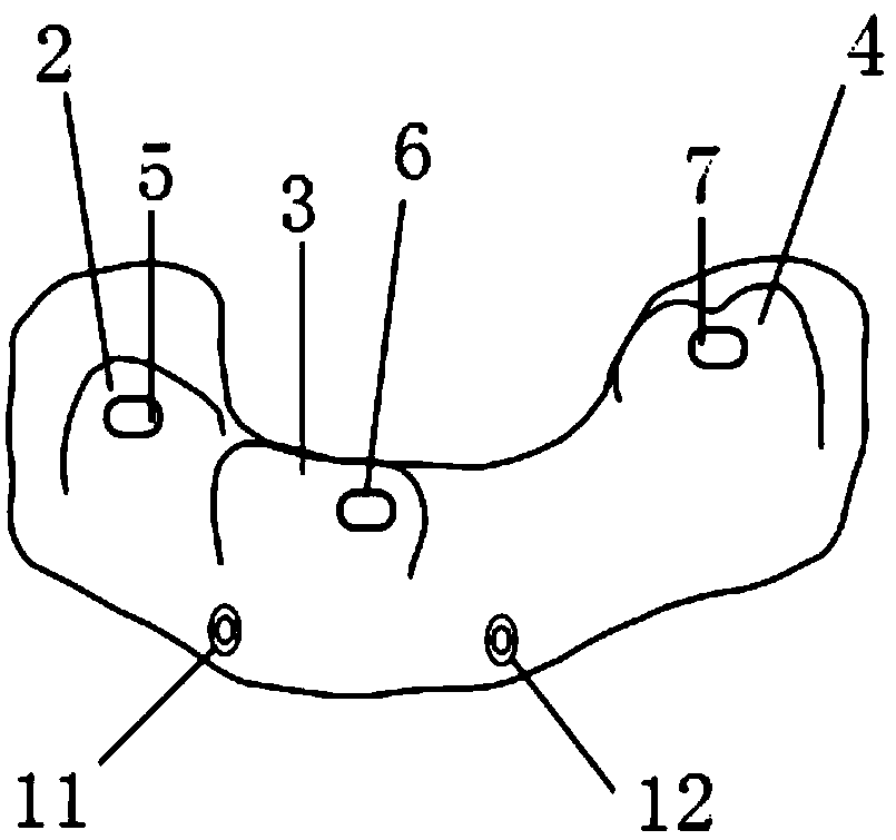 Dental trinity composite guide plate with precise positioning performance and manufacturing method thereof