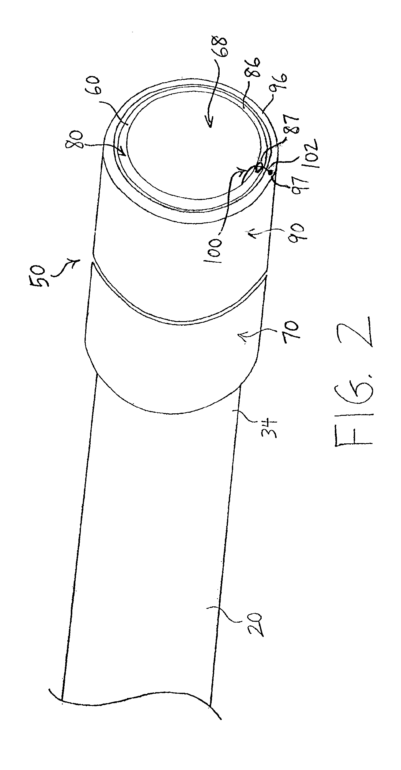 Endoscopic systems and methods for resection of tissue