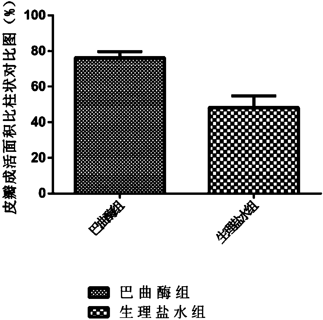 Effects of batroxobin in promoting survival of ischemic super-long random flap