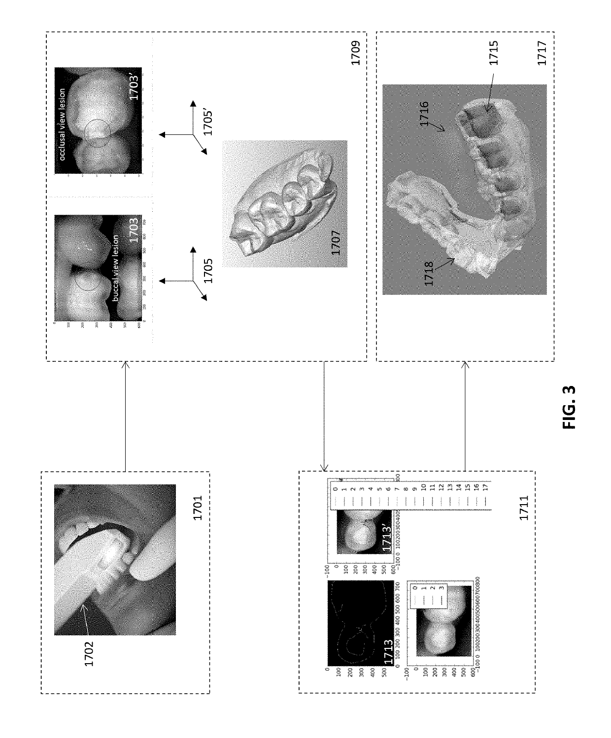 Diagnostic intraoral scanning