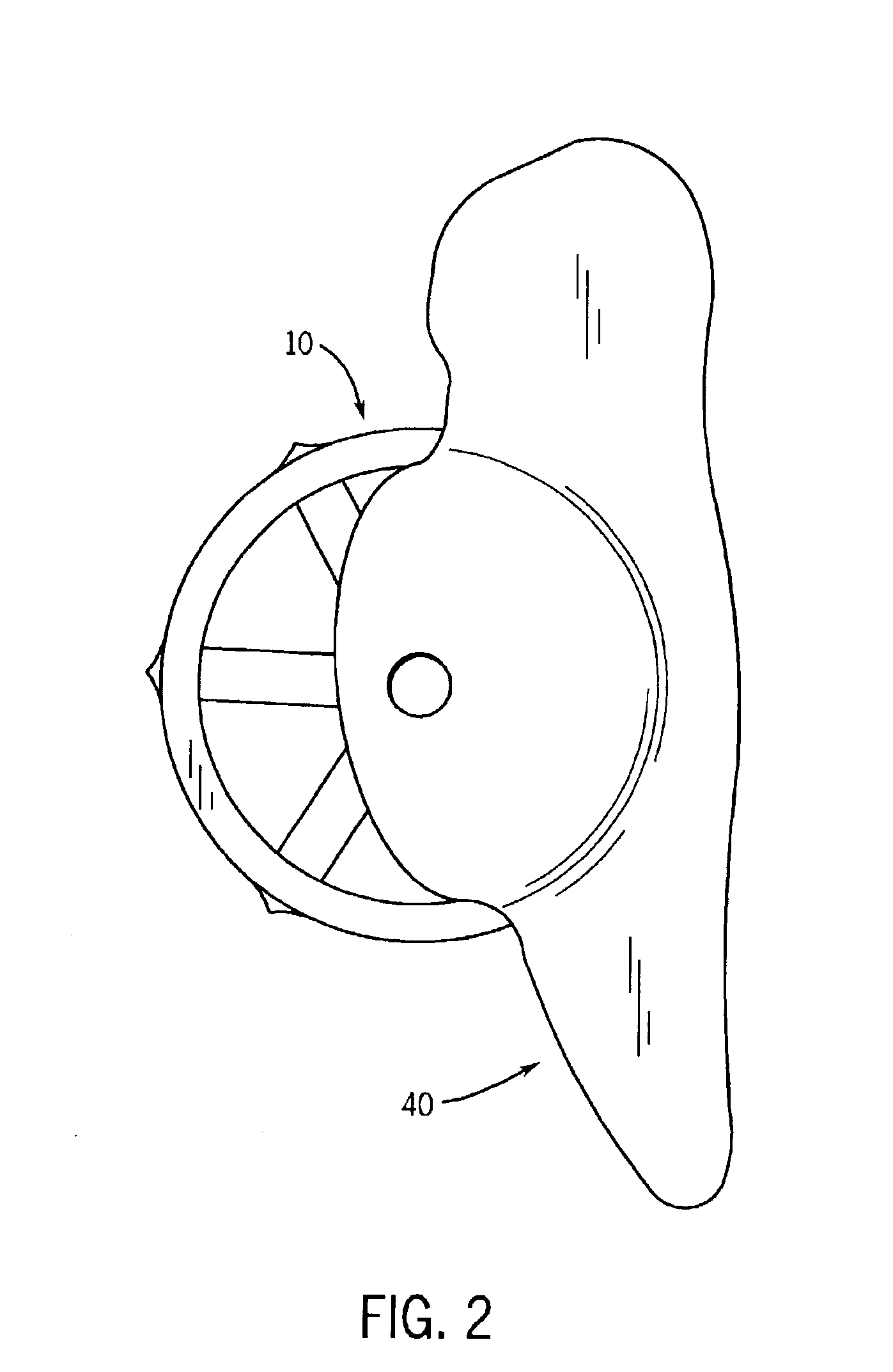 Modular acetabular anti-protrusio cage and porous ingrowth cup combination