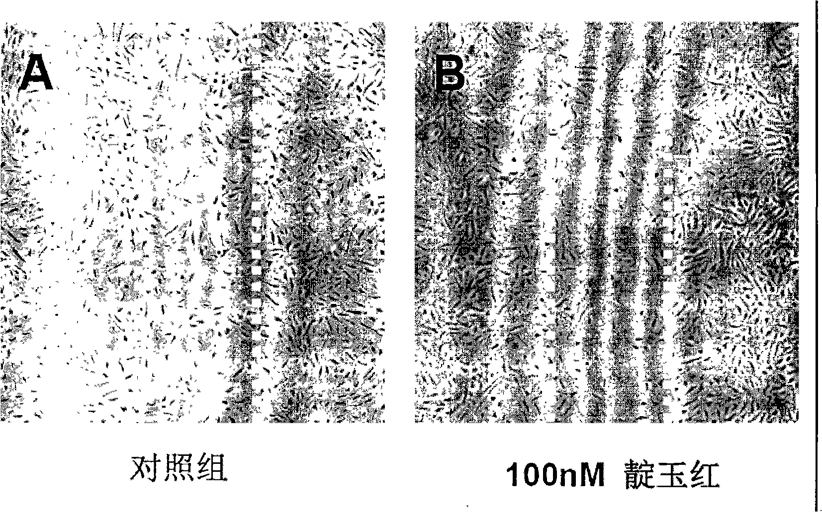 Application of indirubin for preparing medicine for preventing blood vessel from regenerating