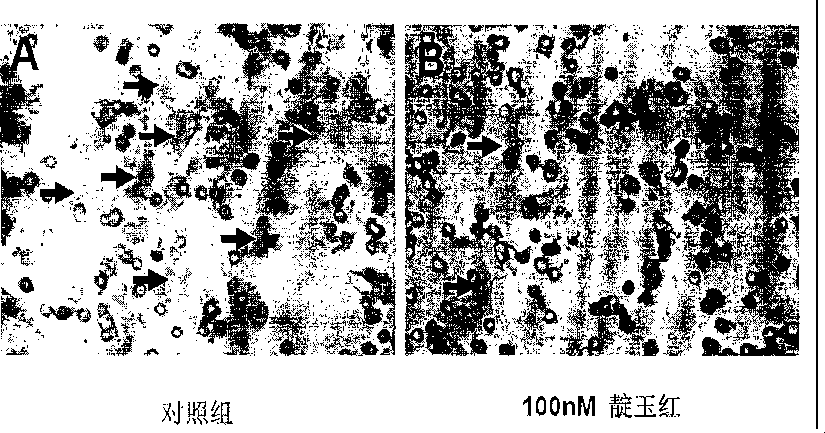 Application of indirubin for preparing medicine for preventing blood vessel from regenerating