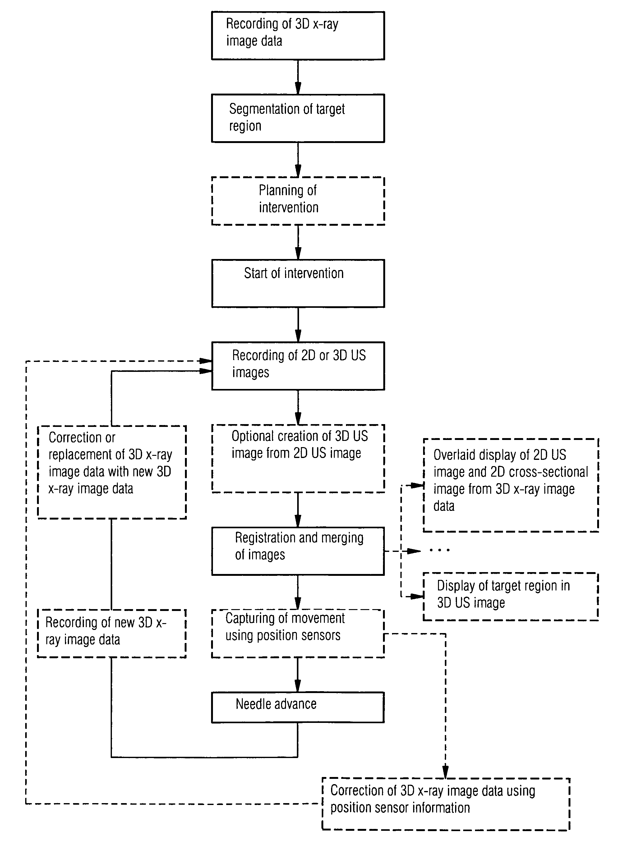 Method for assisting with percutaneous interventions