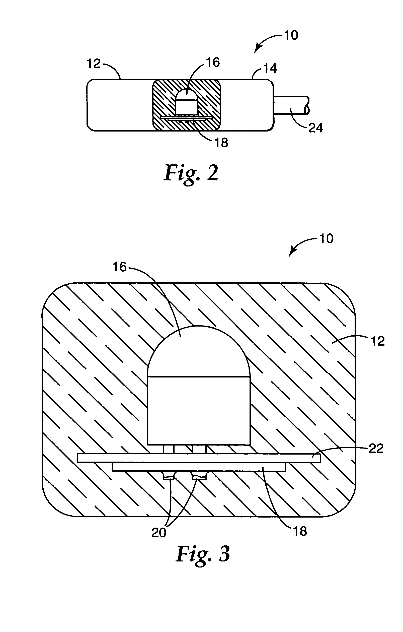 Method and apparatus for bonding orthodontic appliances to teeth