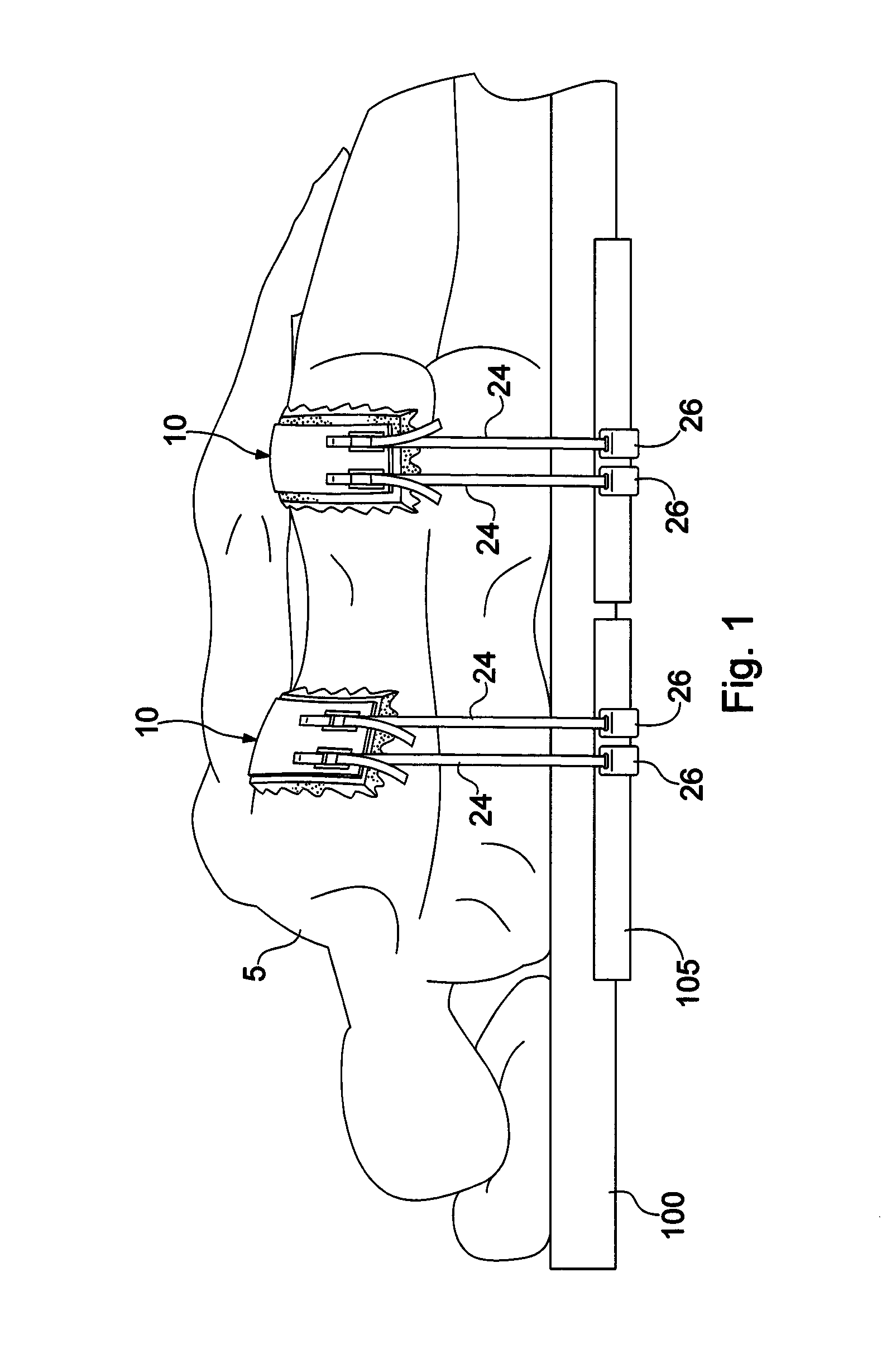 Patient positioning system and method for positioning a patient during a surgical procedure