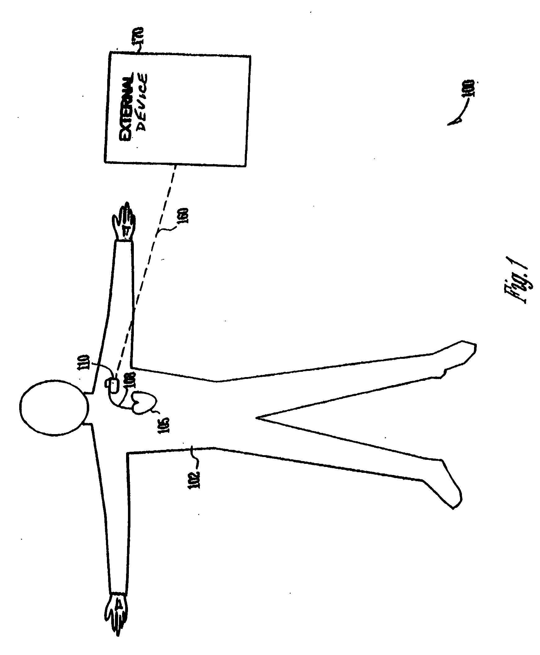 Intracardiac impedance and its applications