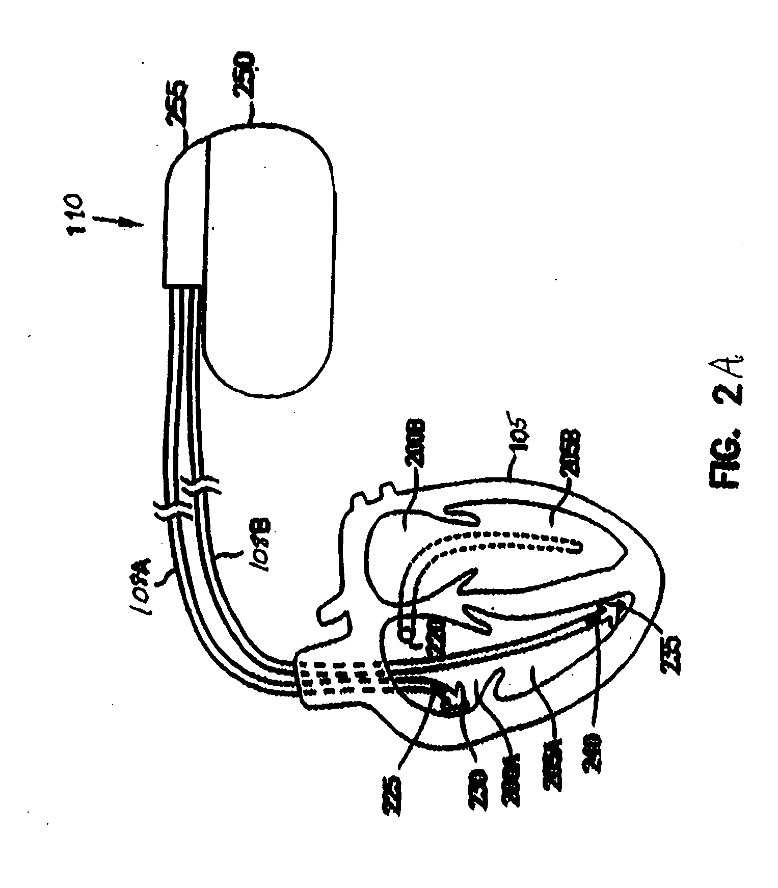 Intracardiac impedance and its applications