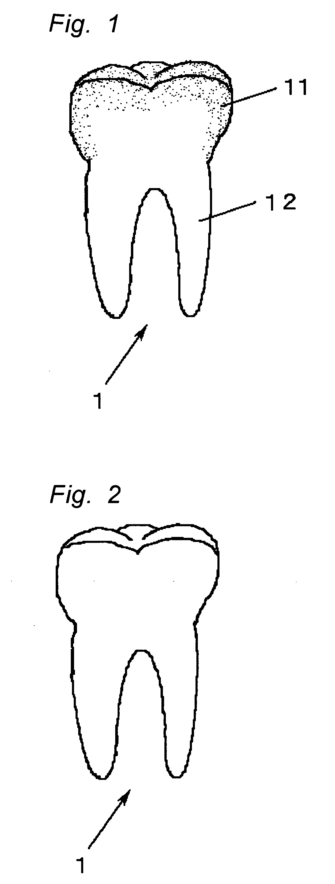 Tooth for tooth model, comprising enamel portion impregnated with resin or low melting point glass, and method for producing the same