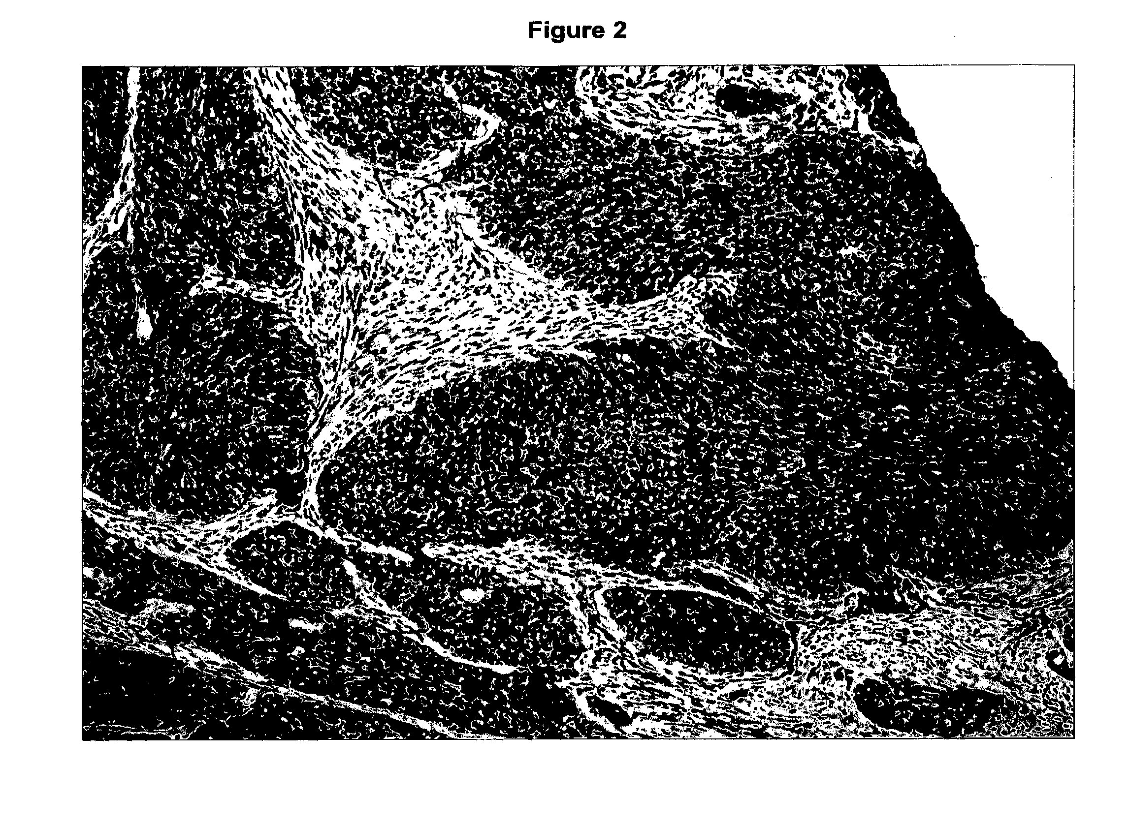 Anti P2X7 receptor antibodies and fragments thereof