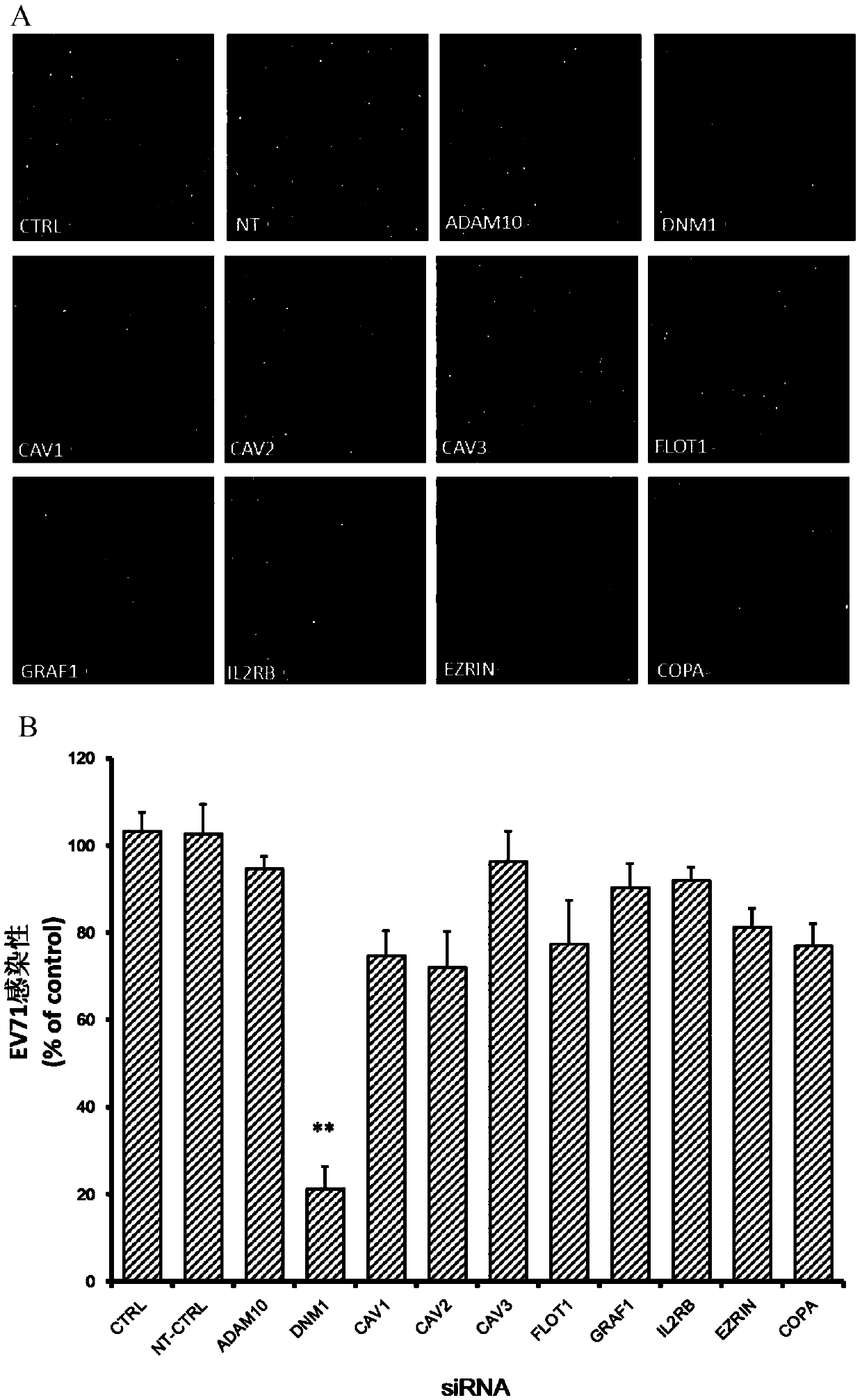 Application of dynamin 1 in prevention and treatment on enterovirus type 71 infection