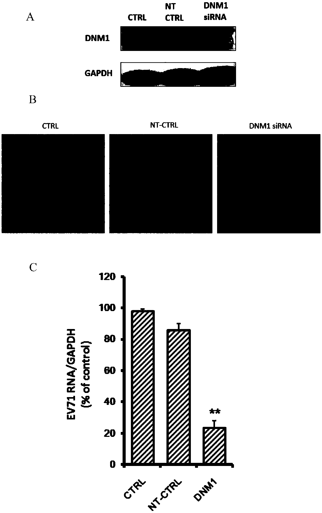 Application of dynamin 1 in prevention and treatment on enterovirus type 71 infection