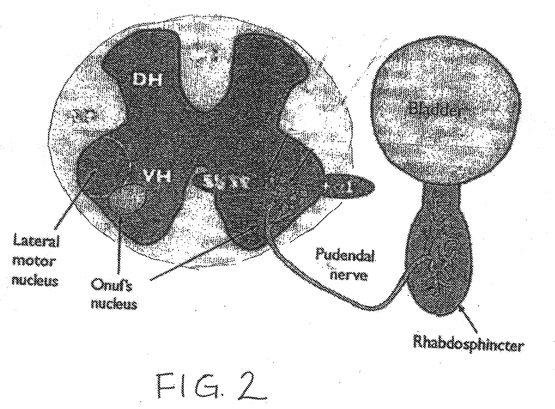 Drug Delivery Methods and Devices for Treating Stress Urinary Incontinence