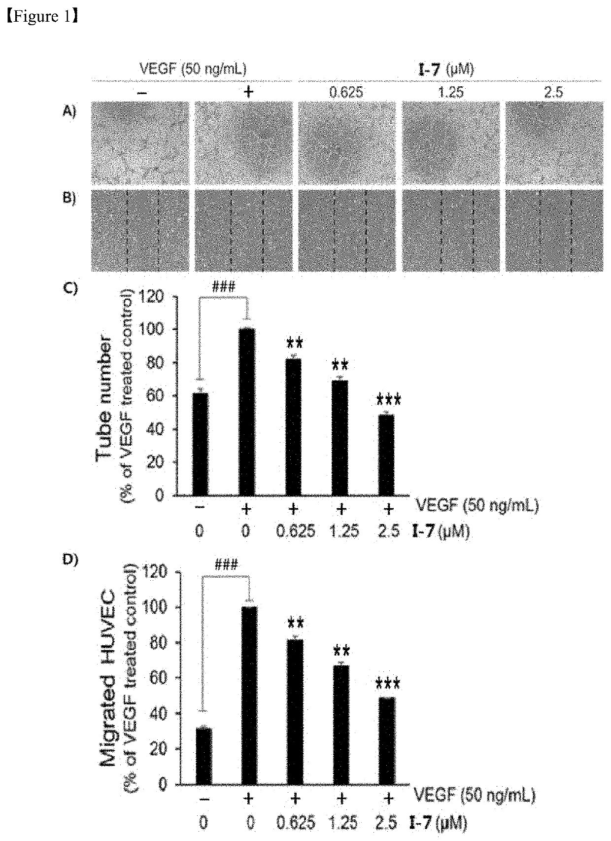 Alkaloid derivative having angiogenesis inhibitory effect, and pharmaceutical composition containing same