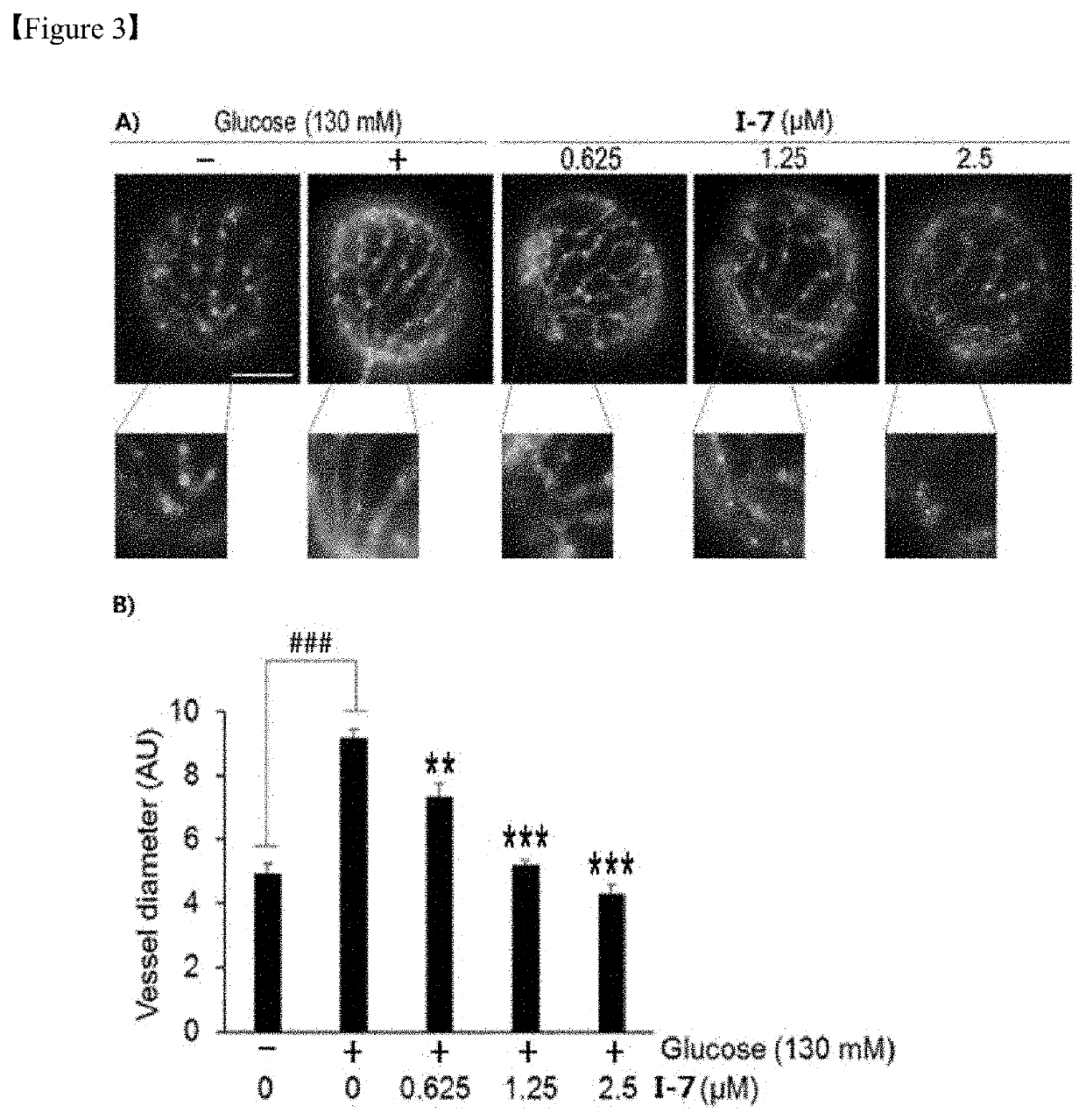 Alkaloid derivative having angiogenesis inhibitory effect, and pharmaceutical composition containing same