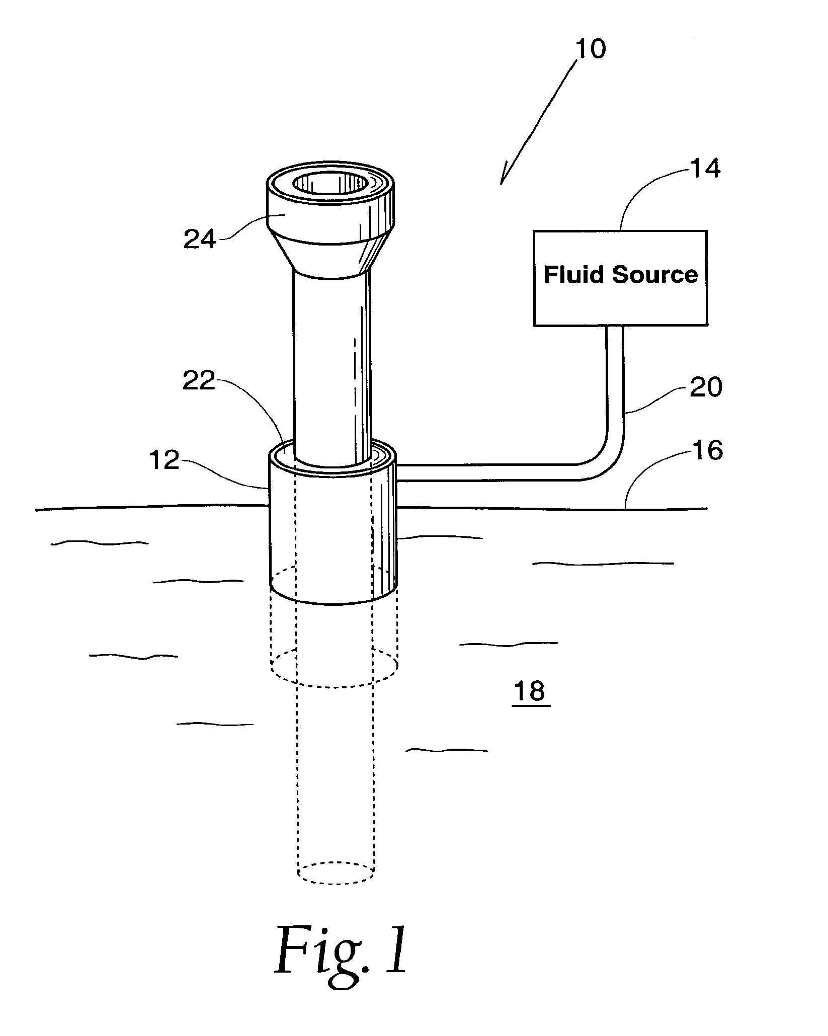 Method and Apparatus for Preventing Air Embolisms