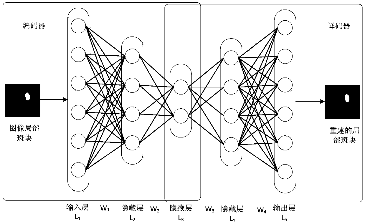 A pulmonary nodule image classification method for constructing feature representation based on an automatic encoder