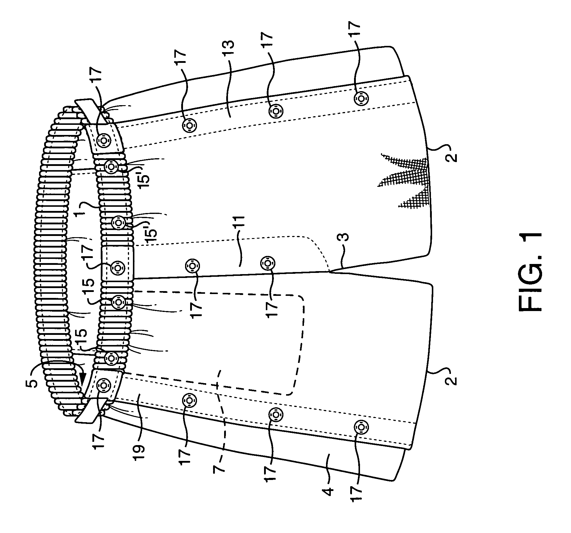 Ostomy bag support garment