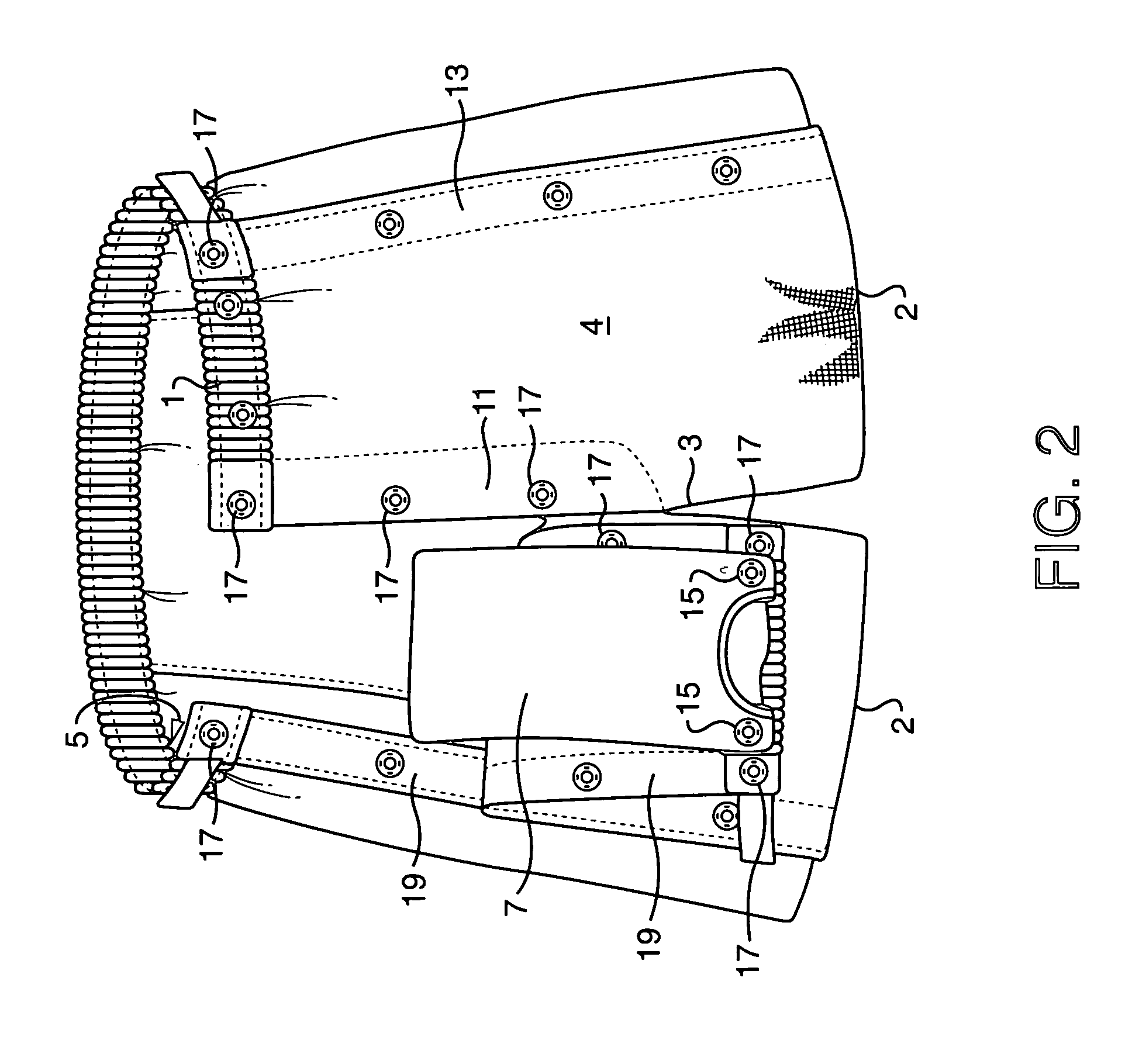 Ostomy bag support garment