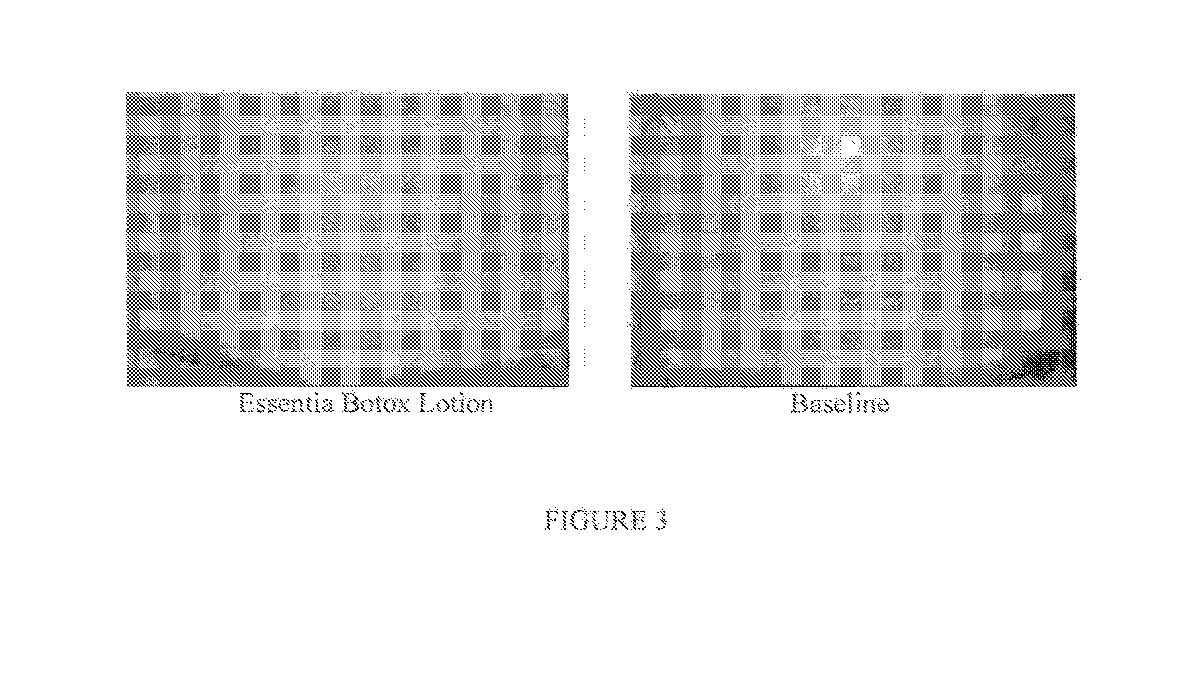 Compositions and Methods for Topical Application and Transdermal Delivery of Botulinum Toxins