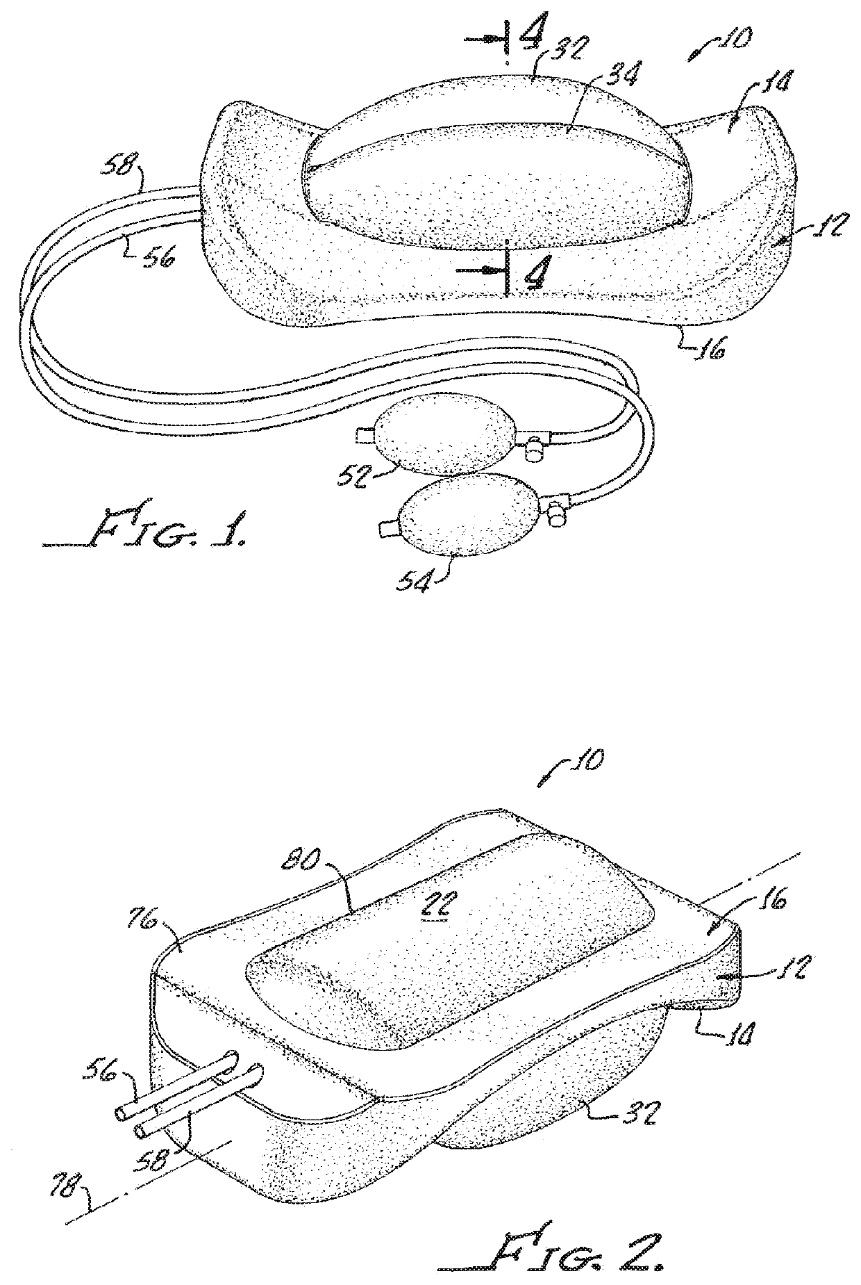 Joint separator for body alignment