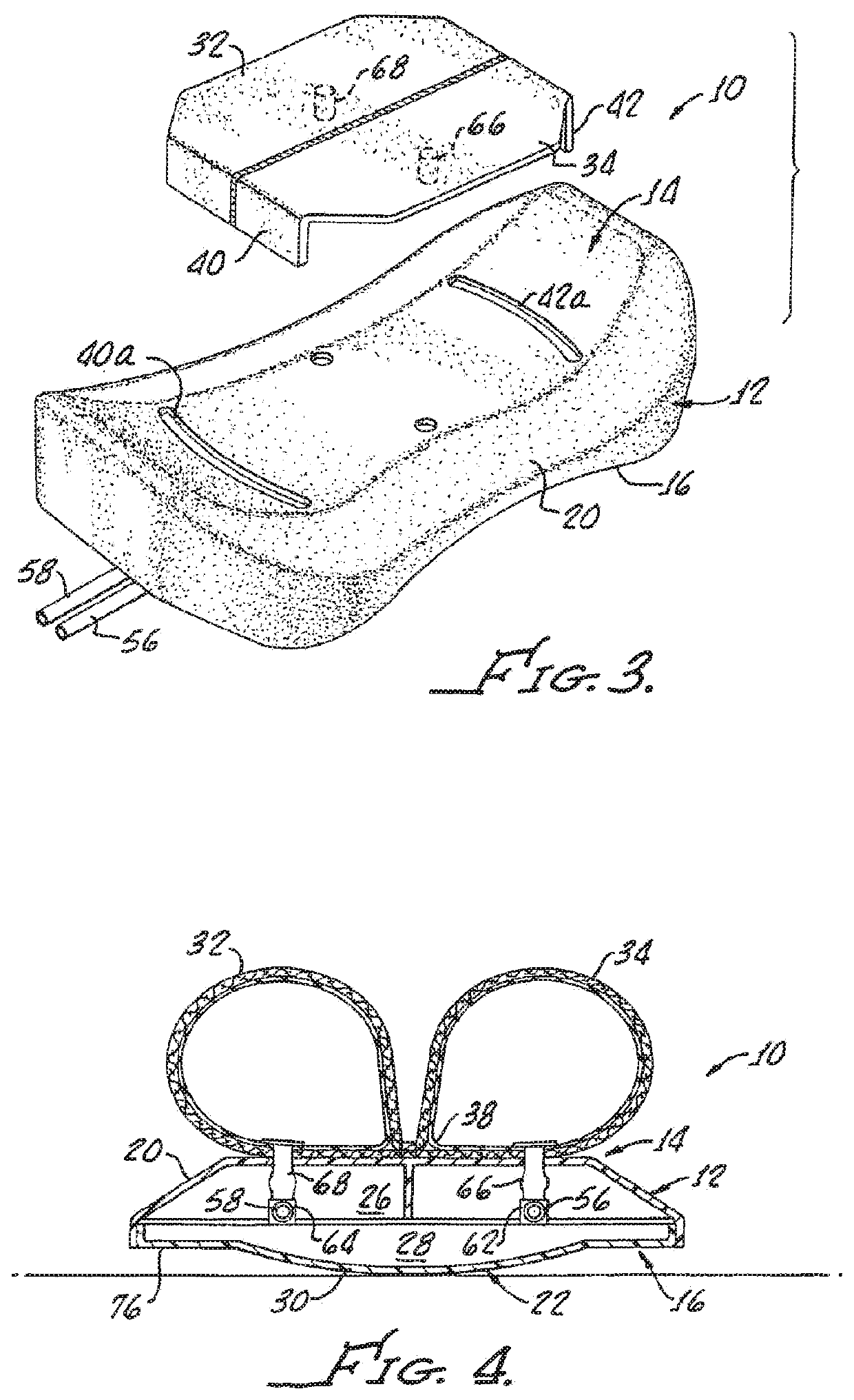 Joint separator for body alignment