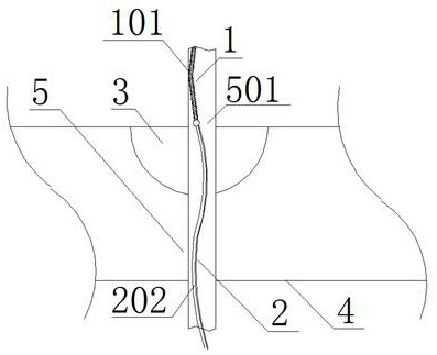 Adjustable implantation positioner and positioning device suitable for lung focus positioning