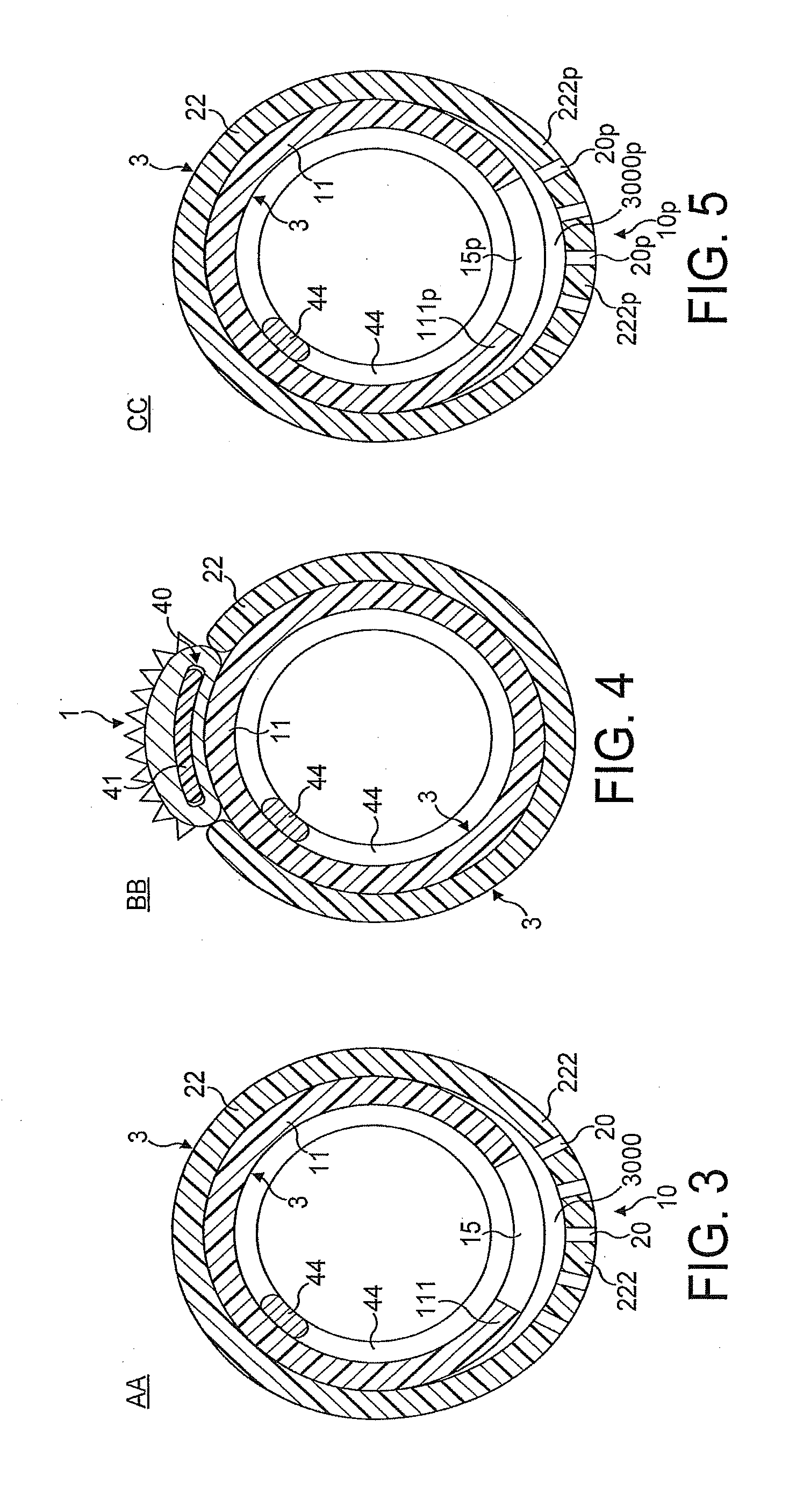 Rotational Atherectomy Device with Fluid Inflatable Support Elements and Two Torque Transmitting Coils