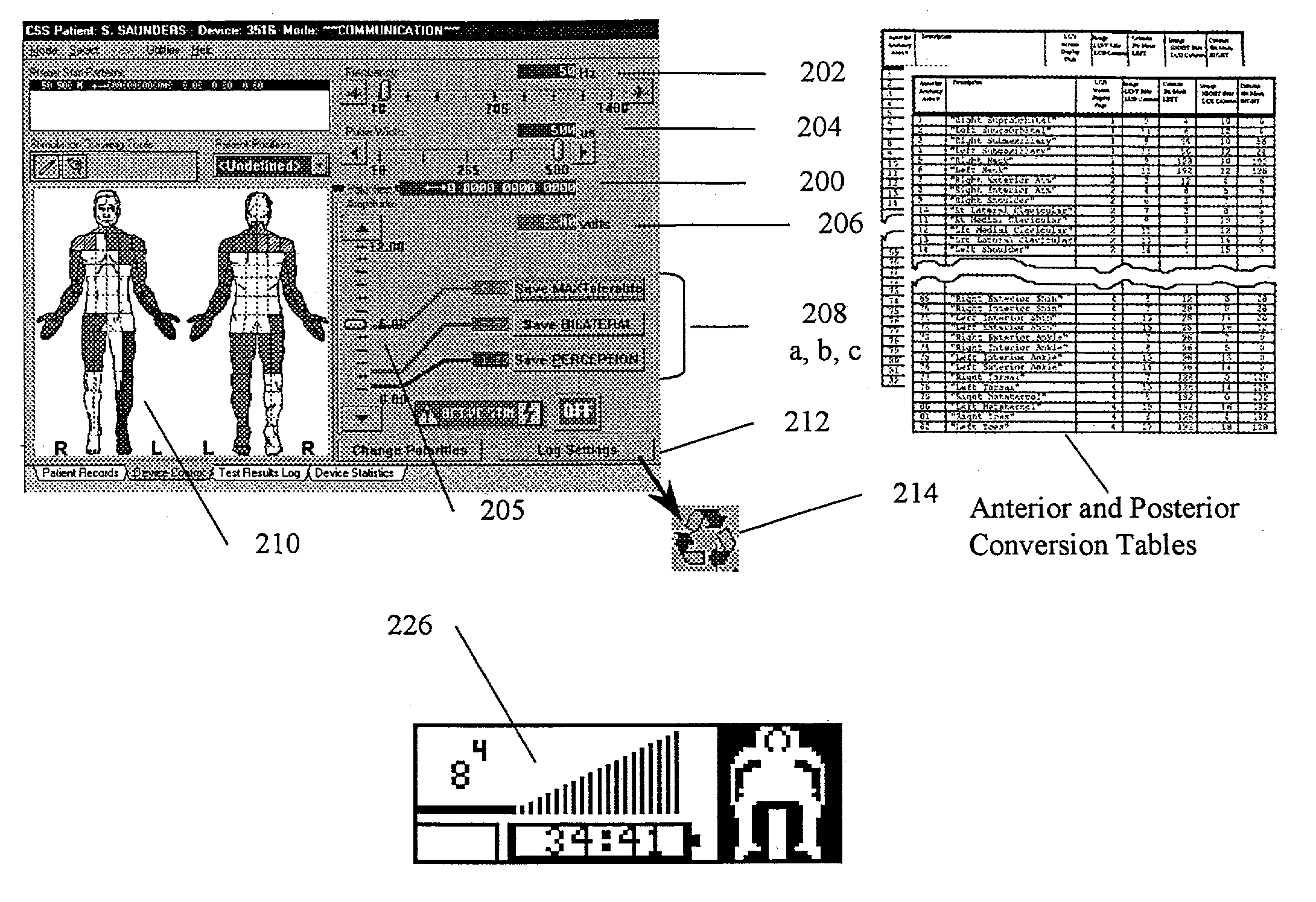 Neuromodulation therapy system and method