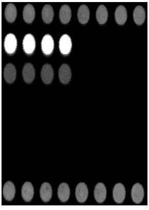 Gene chip and its detection method for identification of six kinds of swine disease pathogens