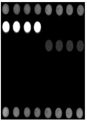 Gene chip and its detection method for identification of six kinds of swine disease pathogens