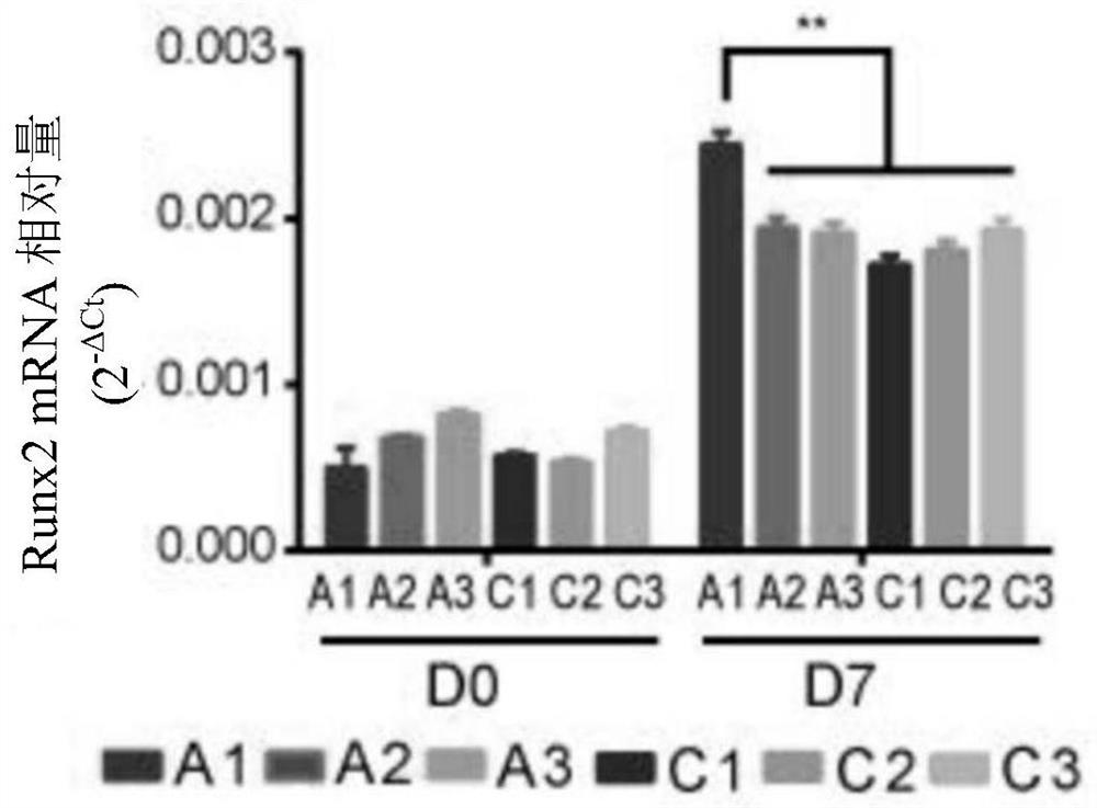 A biomarker and target for diagnosis, prognosis and treatment of ankylosing spondylitis