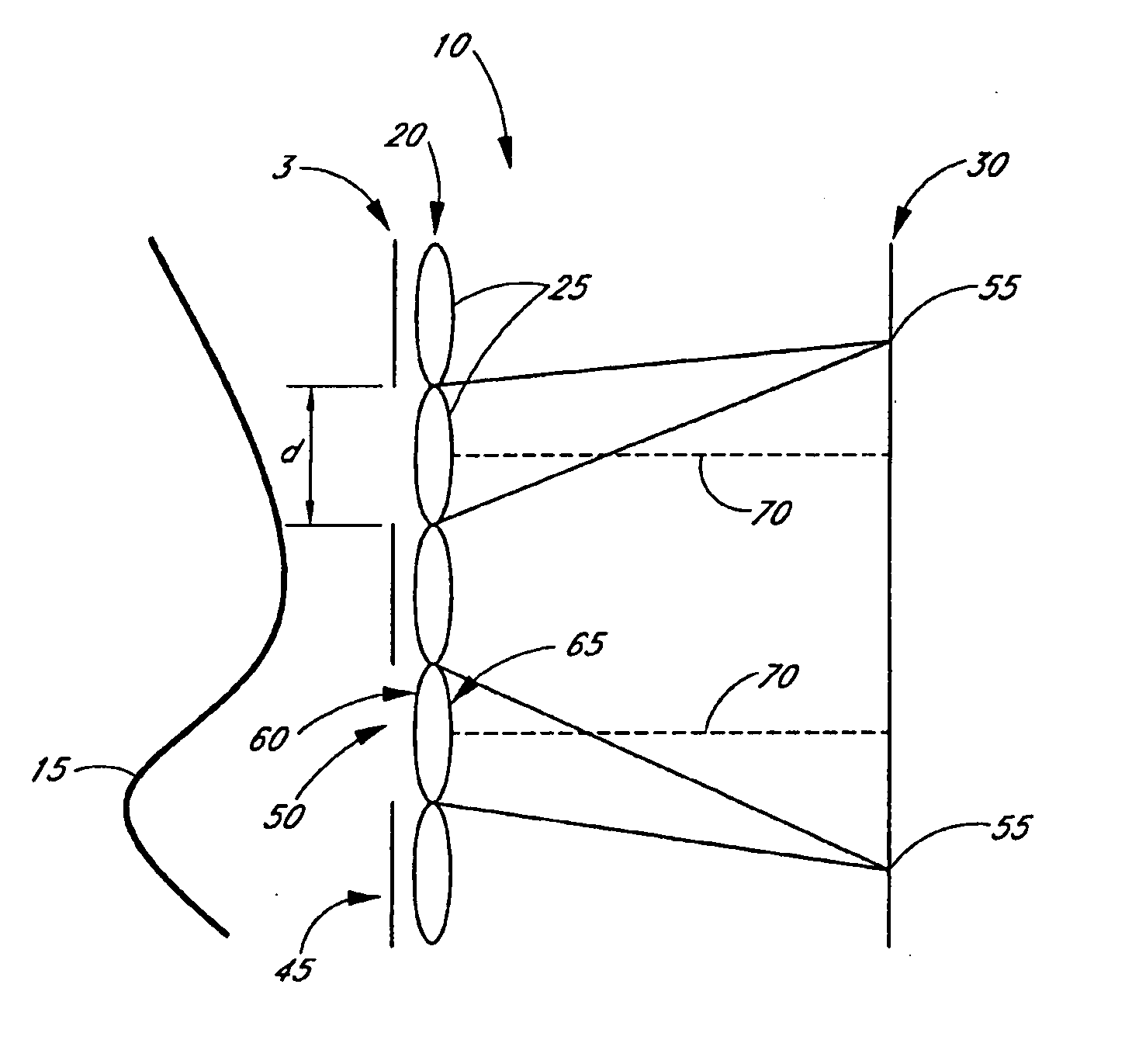 Large dynamic range Shack-Hartmann wavefront sensor