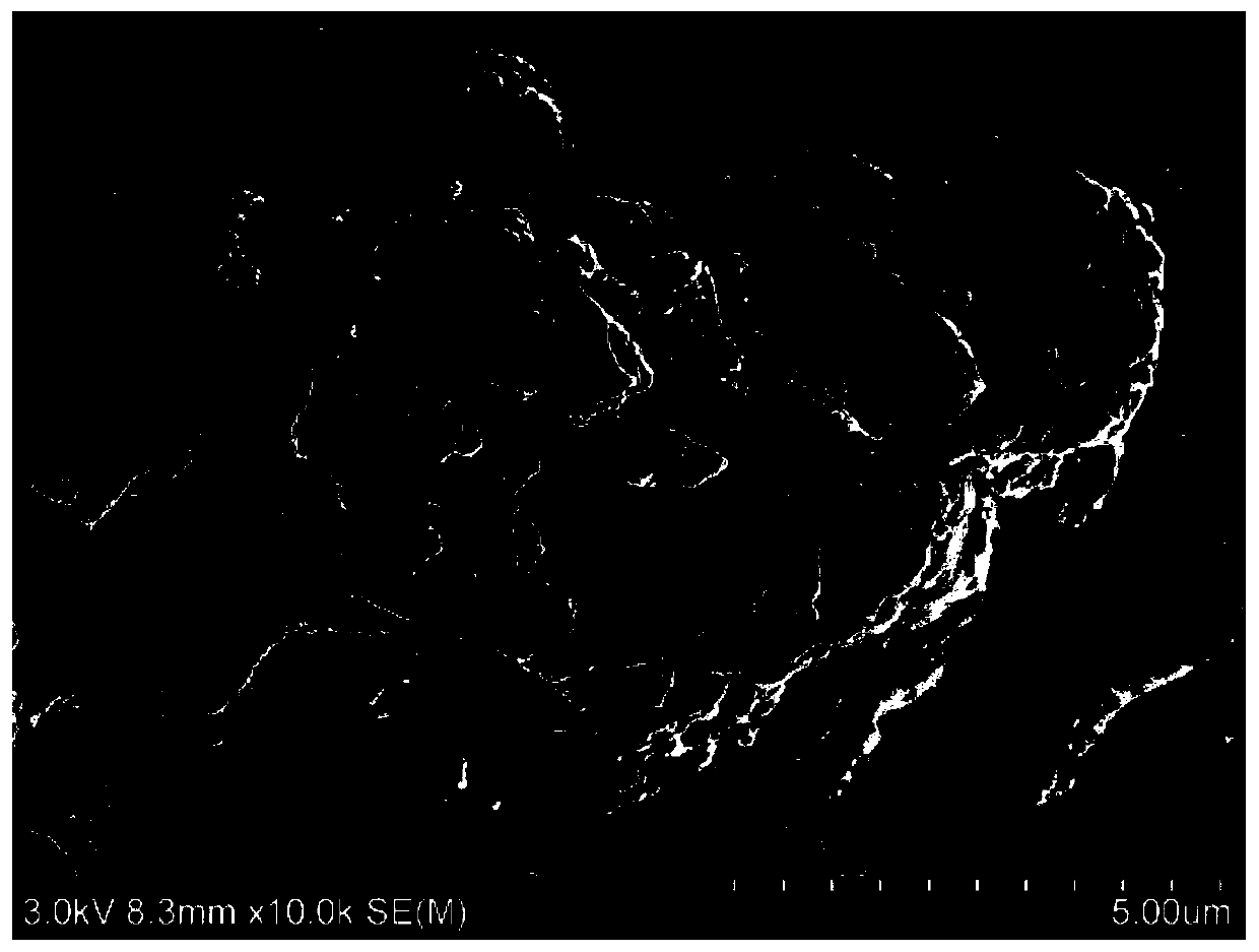 Synthesis method of bagasse xylan citrate-g-BMA with antitumor activity