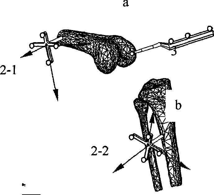 Articular surface movement follow-up measurement method based on virtual mark point