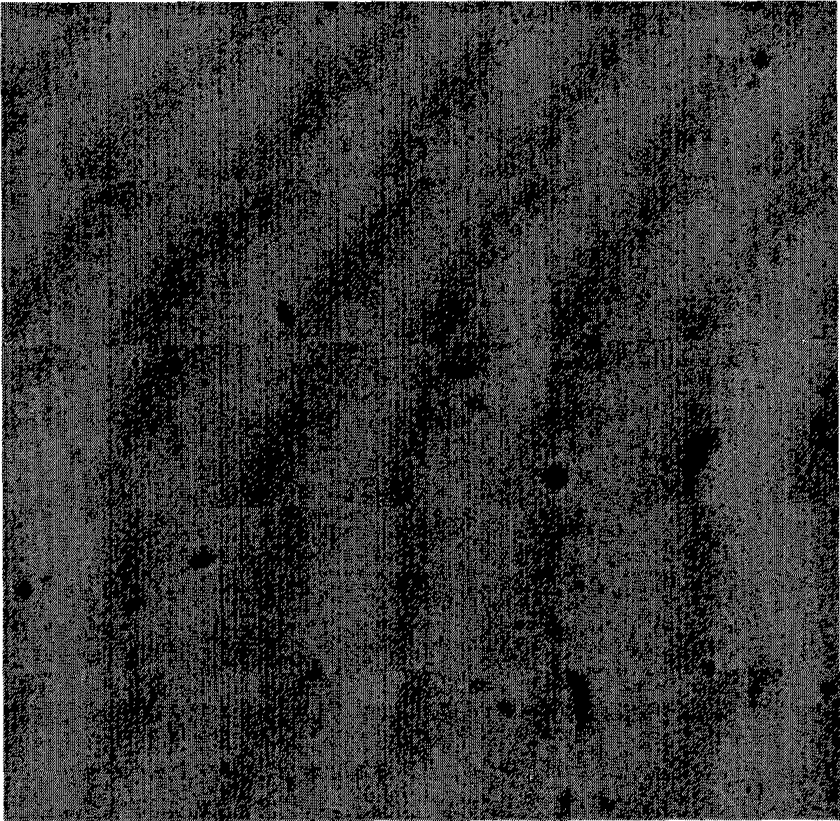 DLK1 gene nucleic acid hybridization in situ detection kit, detection method and uses thereof