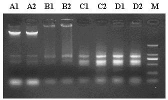 Extraction method of RNA (ribonucleic acid) of rape seeds