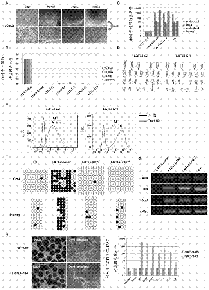 Method for constructing LQT disease model and application of LQT disease model in drug screening