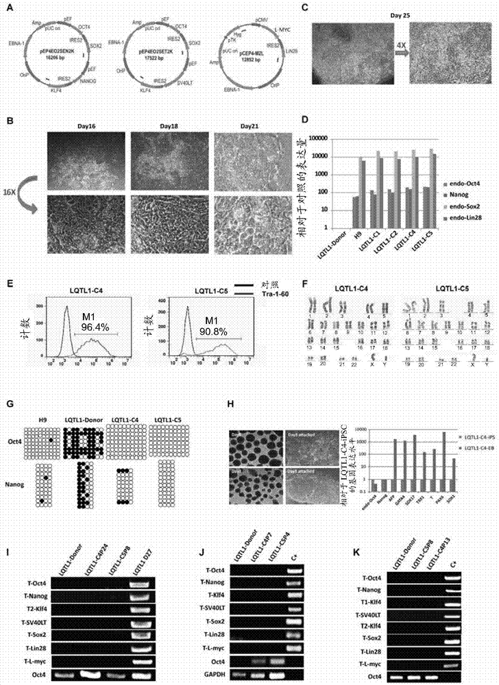 Method for constructing LQT disease model and application of LQT disease model in drug screening