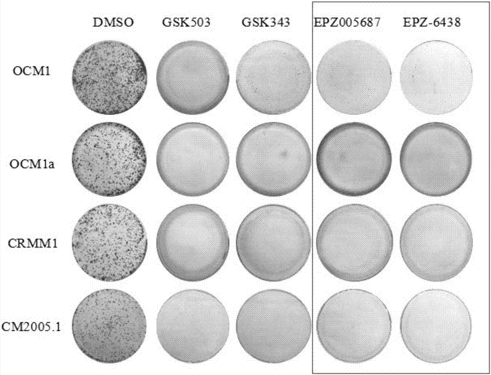 Application of EZH2 (enhancer of zeste homolog 2) inhibitor compounds in preparation of drugs for treating eye melanoma