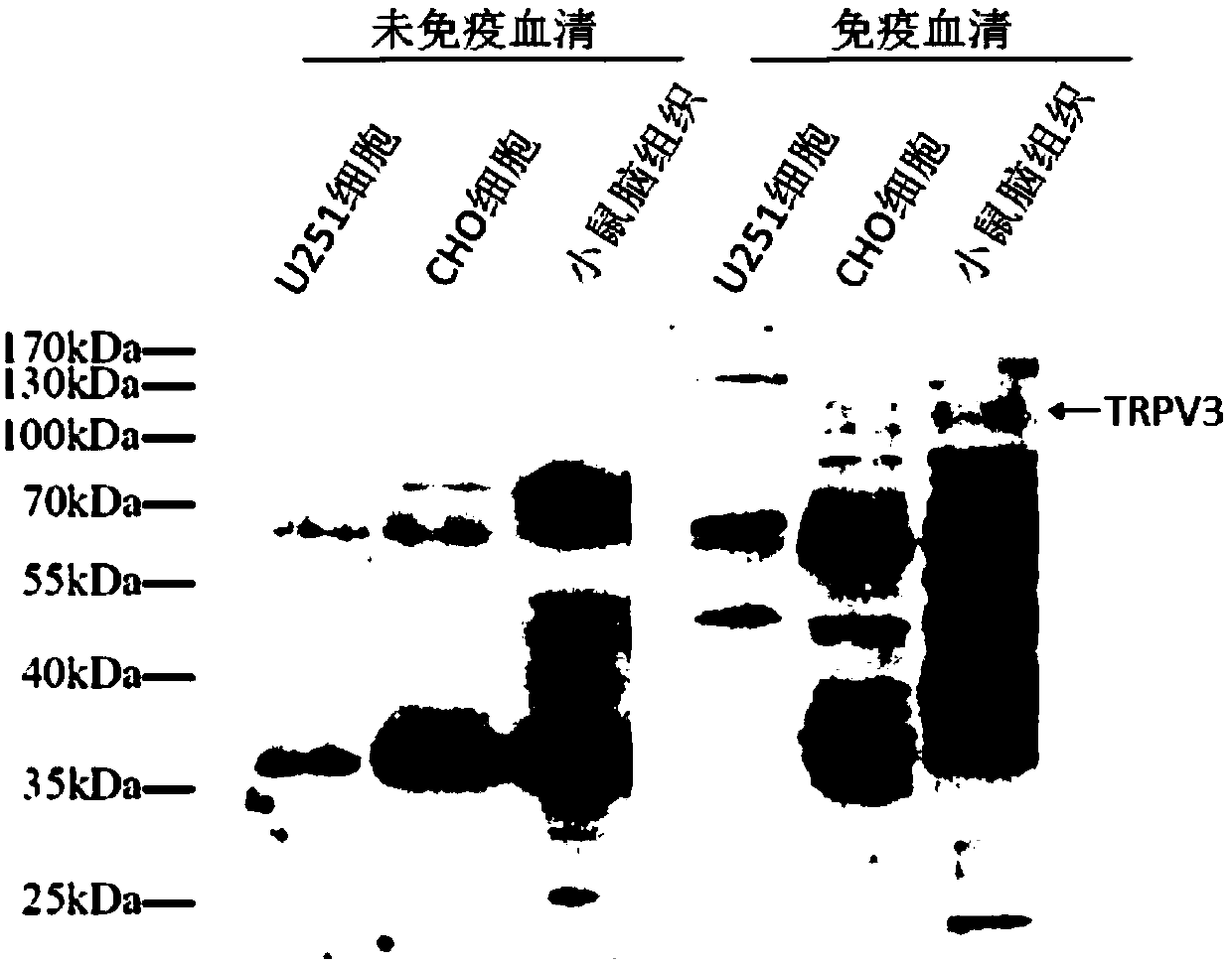 Nano antibody and preparation method and application thereof