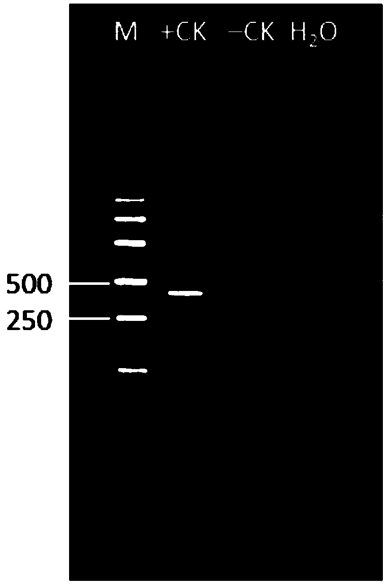 PCR (polymerase chain reaction) Primer pair and method to detect Schlumbergera virus X and application of PCR primer pair