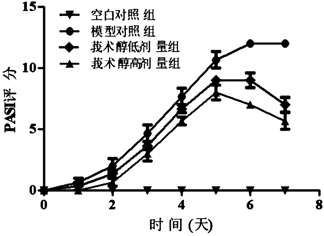 Application of curcumol in preparing medicine for preventing and treating psoriasis