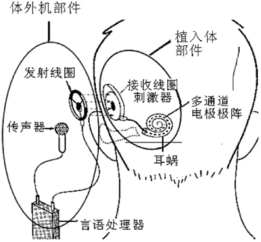 Electrical cochlea speech processor and processing method with signal compression in wide dynamic range