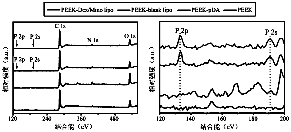 Lipidosome-based method for modifying PEEK (polyetheretherketone) surface with hexadecadrol/minocycline and application