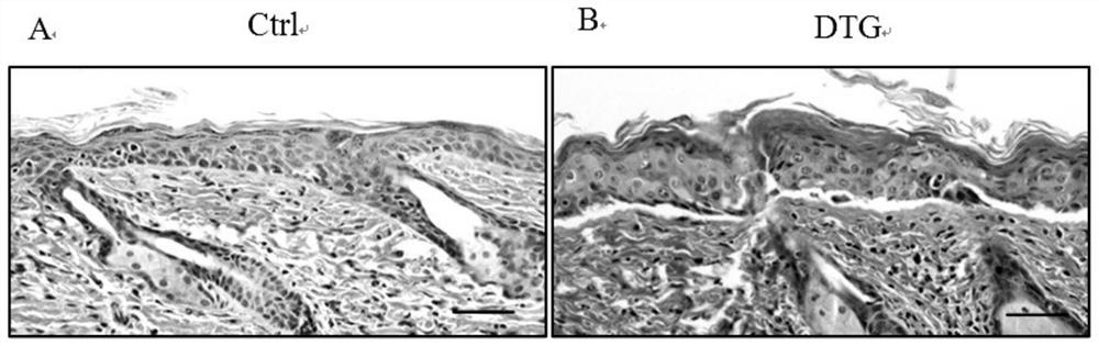 Construction method of mouse model of extramammary Paget disease