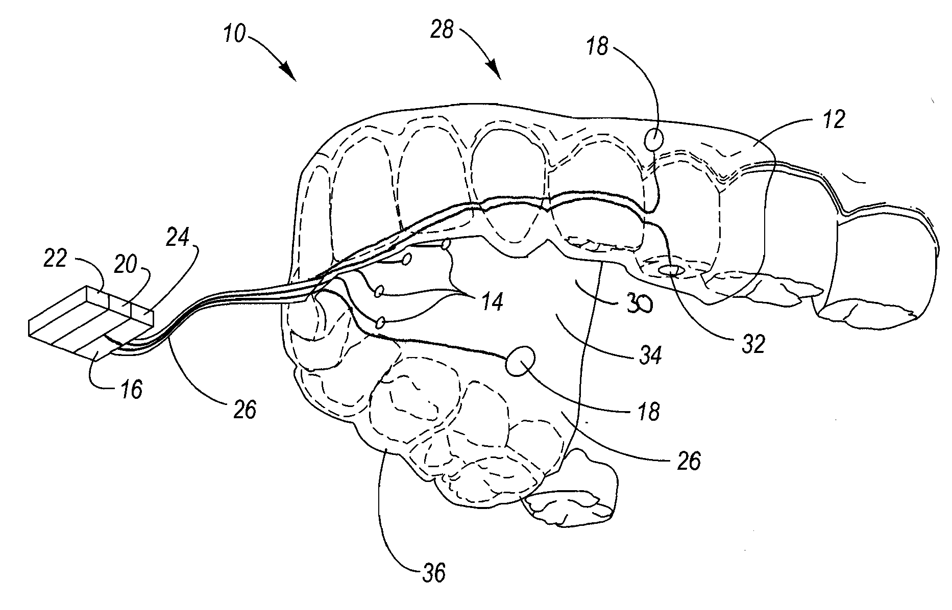 Oral Device