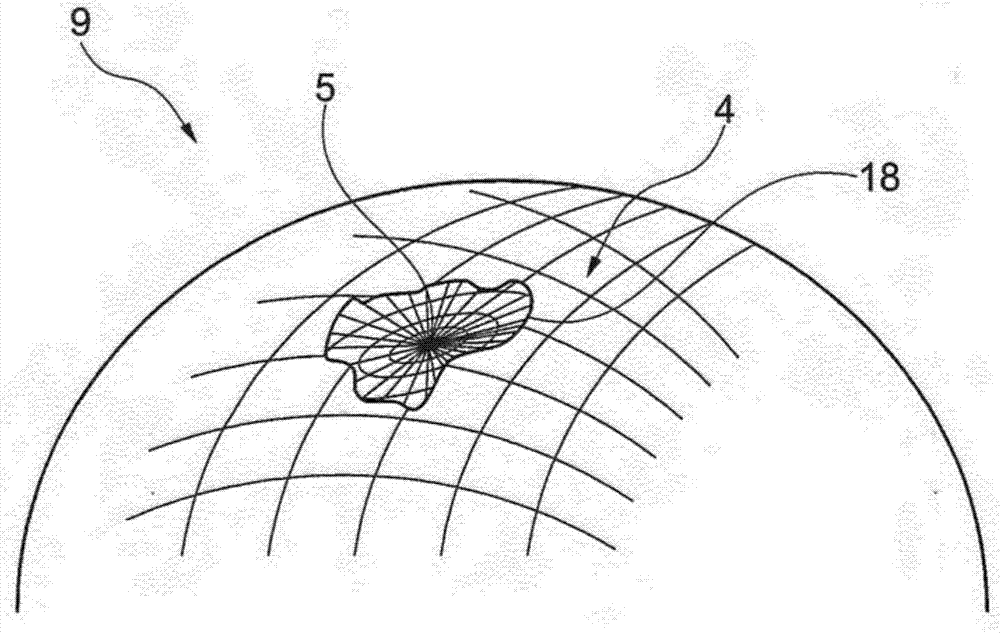 Surgical membrane